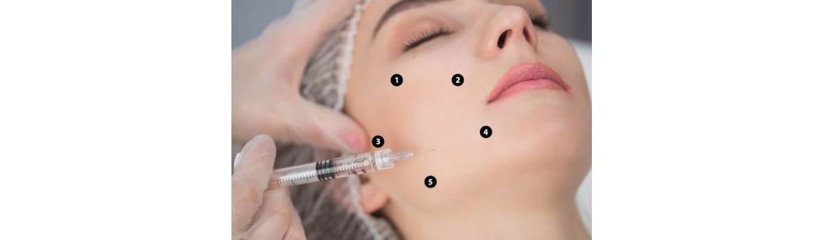 Kỹ Thuật Bap Trẻ Hoá Lâu Dài