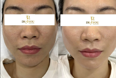 Điều Trị Da Bình Thạnh 