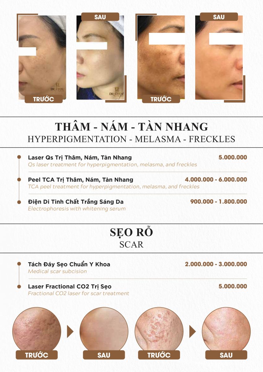 Bảng giá dịch vụ điều trị sẹo lồi, sẹo rỗ tại Dr4you.