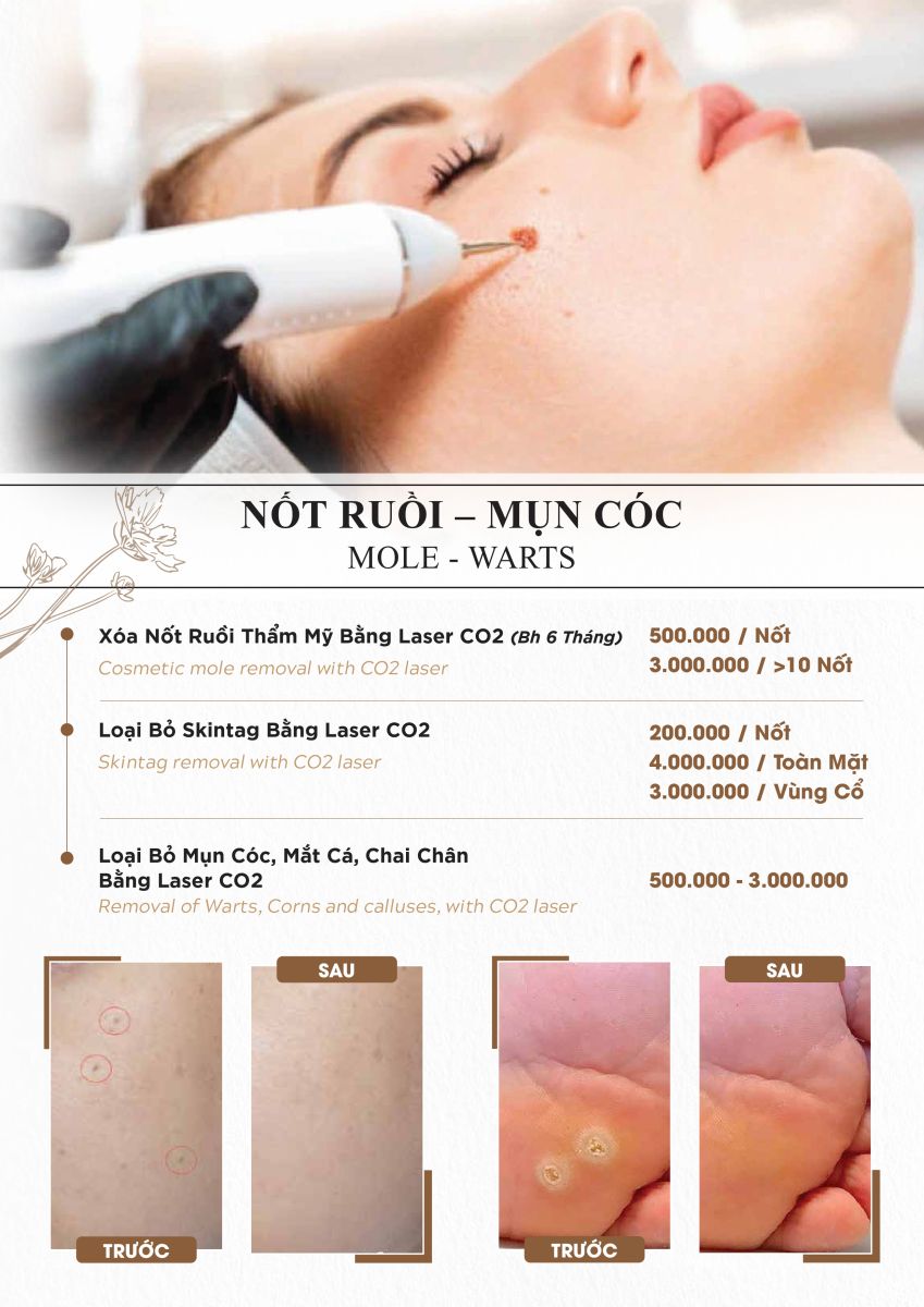 Bảng giá dịch vụ điều trị nốt ruồi, mụn cóc tại Dr4you.