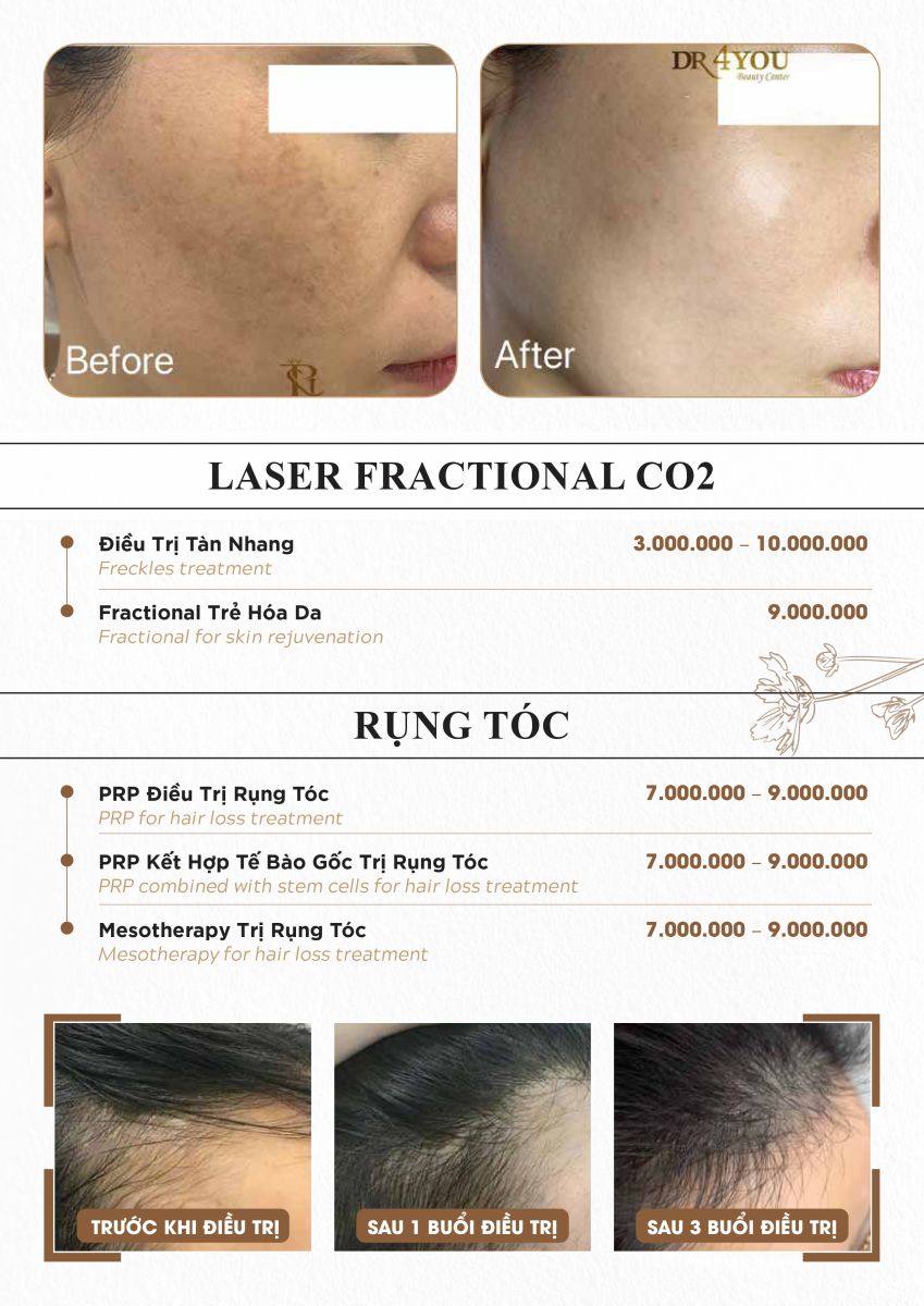 Bảng giá dịch vụ điều trị rụng tóc tại Dr4you.