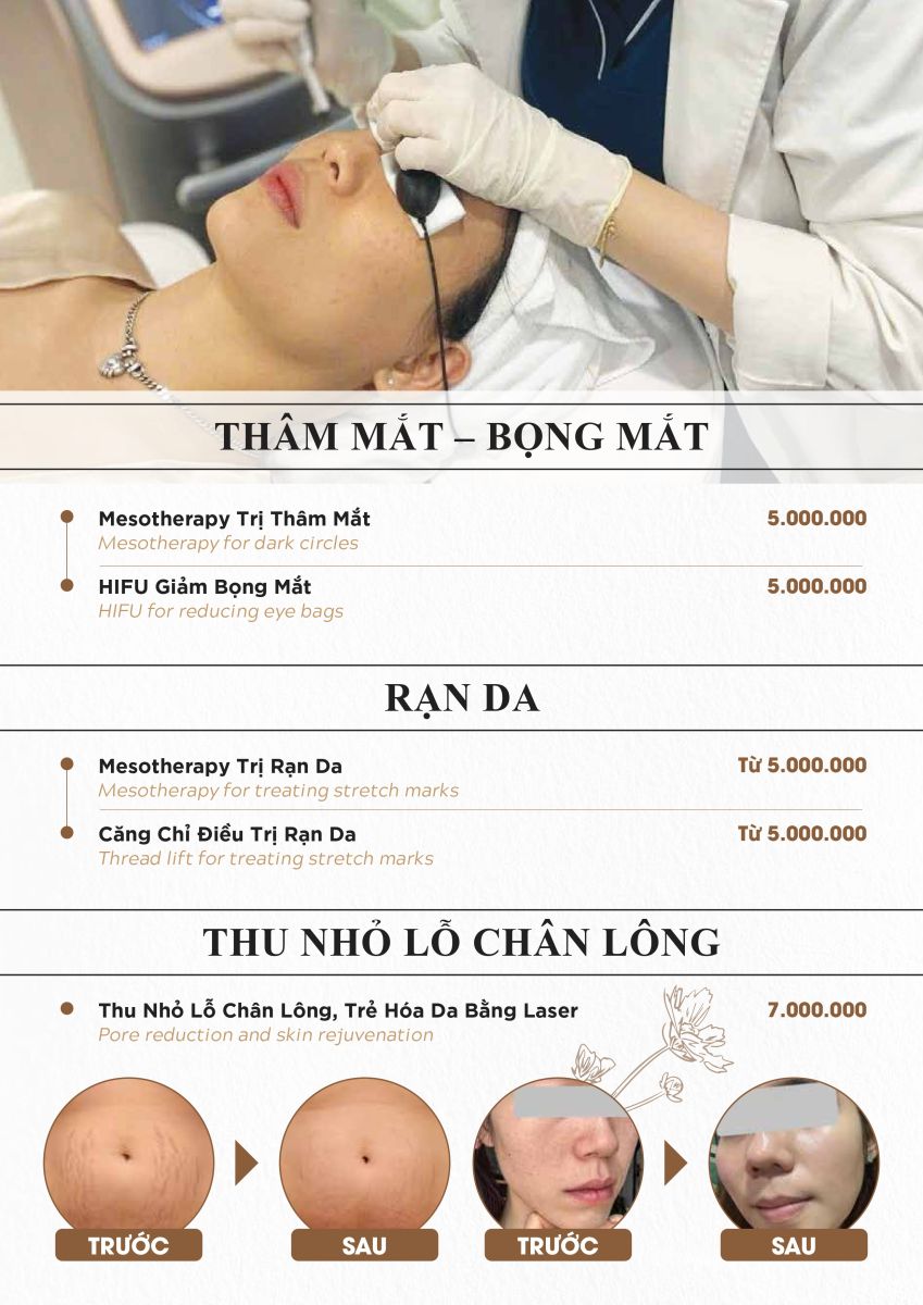 Bảng giá dịch vụ điều trị rạn da tại Dr4you.